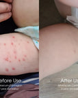 Soothing balm for dry, sensitive skin