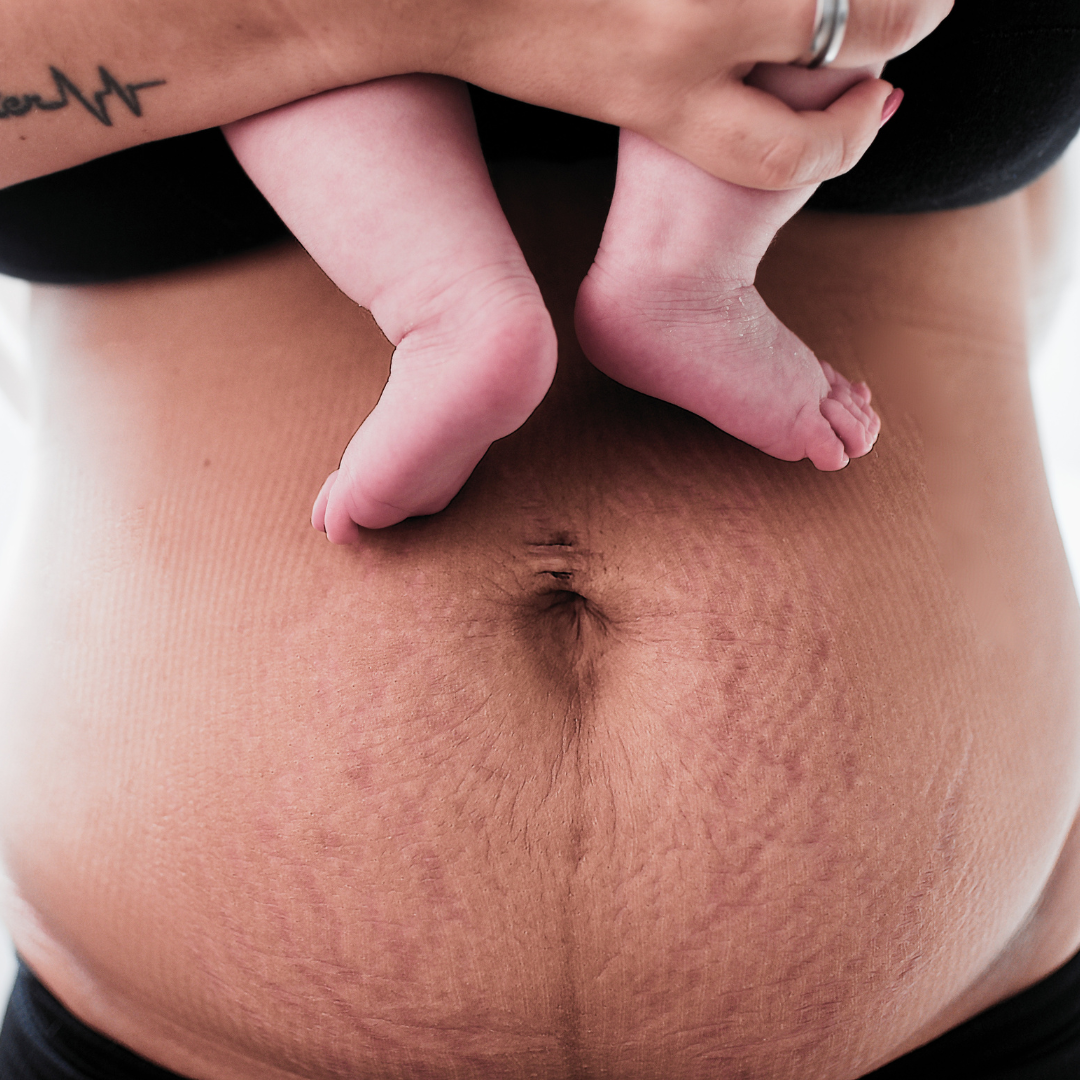 postpartum recovery products