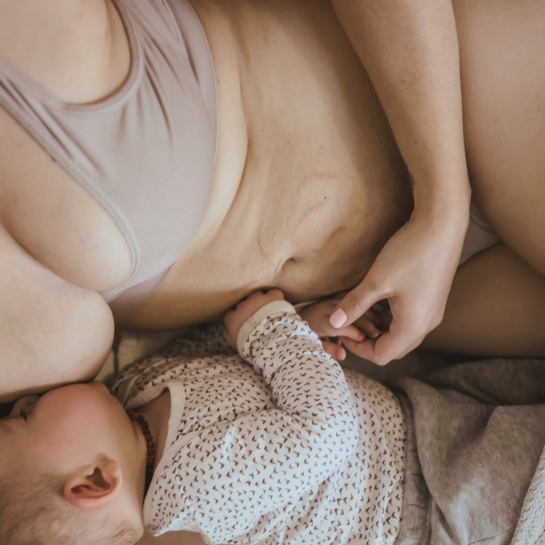 postpartum skincare